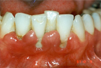 Before